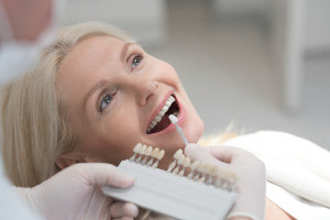 facettes-dentaires-trop-blanches-quelles-consequences-dentiste-serris