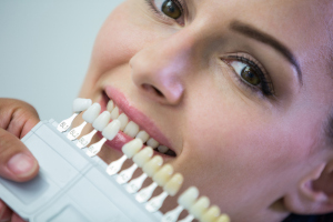 teinte-des-dents-un-choix-complexe-dentiste-serris