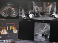 dentiste à nanteuil les meaux 77  radiographie dent 