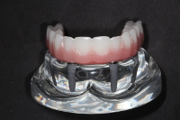 dentiste meaux dentier 1